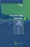 Fractures of the Tibial Pilon 2004 9788847002487 Front Cover