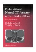 Pocket Atlas of Normal CT Anatomy of the Head and Brain 