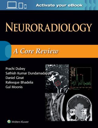 Neuroradiology: A Core Review  9781496372505 Front Cover