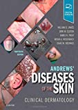 Andrews&#39; Diseases of the Skin Clinical Dermatology