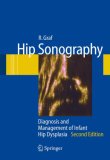 Hip Sonography Diagnosis and Management of Infant Hip Dysplasia 2nd 2006 Revised  9783540309574 Front Cover