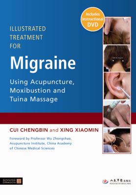 Illustrated Treatment for Migraine Using Acupuncture, Moxibustion and Tuina Massage 2011 9781848190610 Front Cover