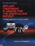 Implant Treatment Planning for the Edentulous Patient A Graftless Approach to Immediate Loading cover art