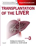 Transplantation of the Liver 3rd 9781455702688 Front Cover