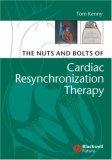 Nuts and Bolts of Cardiac Resynchronization Therapy 