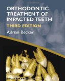 Orthodontic Treatment of Impacted Teeth 3rd 2012 9781444336757 Front Cover