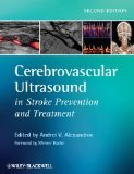 Cerebrovascular Ultrasound in Stroke Prevention and Treatment 