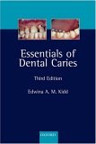 Essentials of Dental Caries The Disease and Its Management 3rd 9780198529781 Front Cover