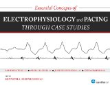 Essential Concepts of Electrophysiology and Pacing Through Case Studies  9781935395850 Front Cover