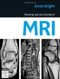 Planning and Positioning in MRI 