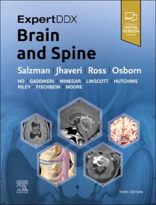 ExpertDDx: Brain and Spine 3rd 9780443106941 Front Cover