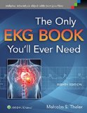 Only EKG Book You&#39;ll Ever Need 