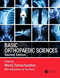 Basic Orthopaedic Sciences 2nd 9781444120981 Front Cover