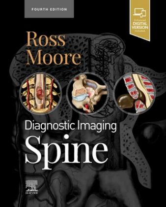 Diagnostic Imaging: Spine 4th 9780323793995 Front Cover