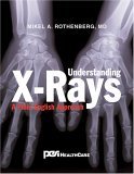 Understanding X-rays: A Plain English Approach cover art